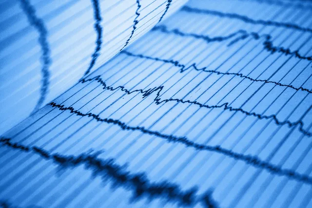 analysis, beat, blue, cardiogram, cardiology, care, chart, complex, diagnosis, digital, doctor, ecg, ekg, electrocardiogram, blue doctors, blue care. Unklare Testergebnisse nicht als Gewinner ausgeben